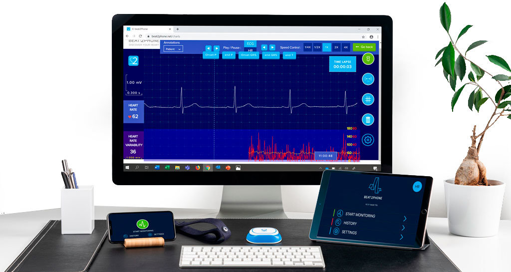 Beat2Phone ECG -pilvipalvelu eri laitteilla